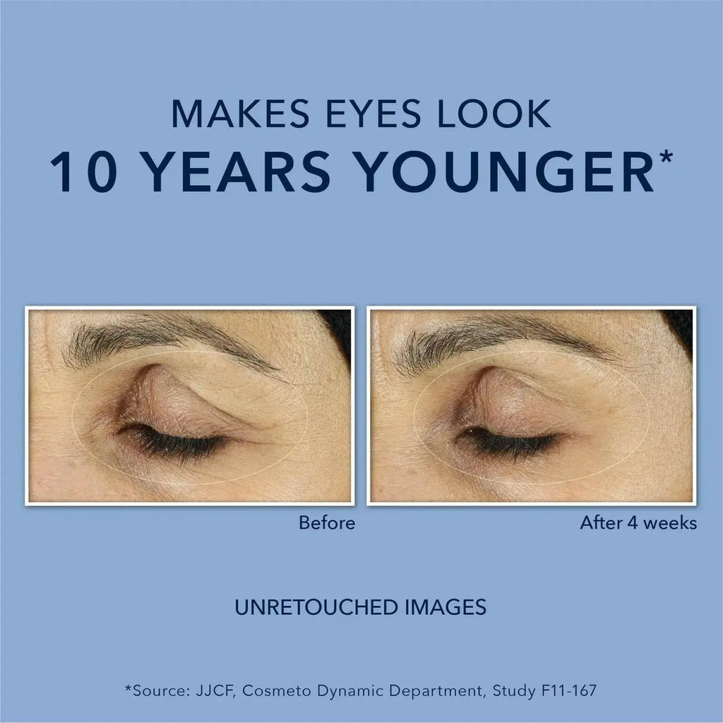 Roc Retinol Anti-Wrinkle + Firming Eye Paste For Dark Circles & Puffy Eyes Retinol Anti-Wrinkle Firming Eye Cream - ACHETE LTD
