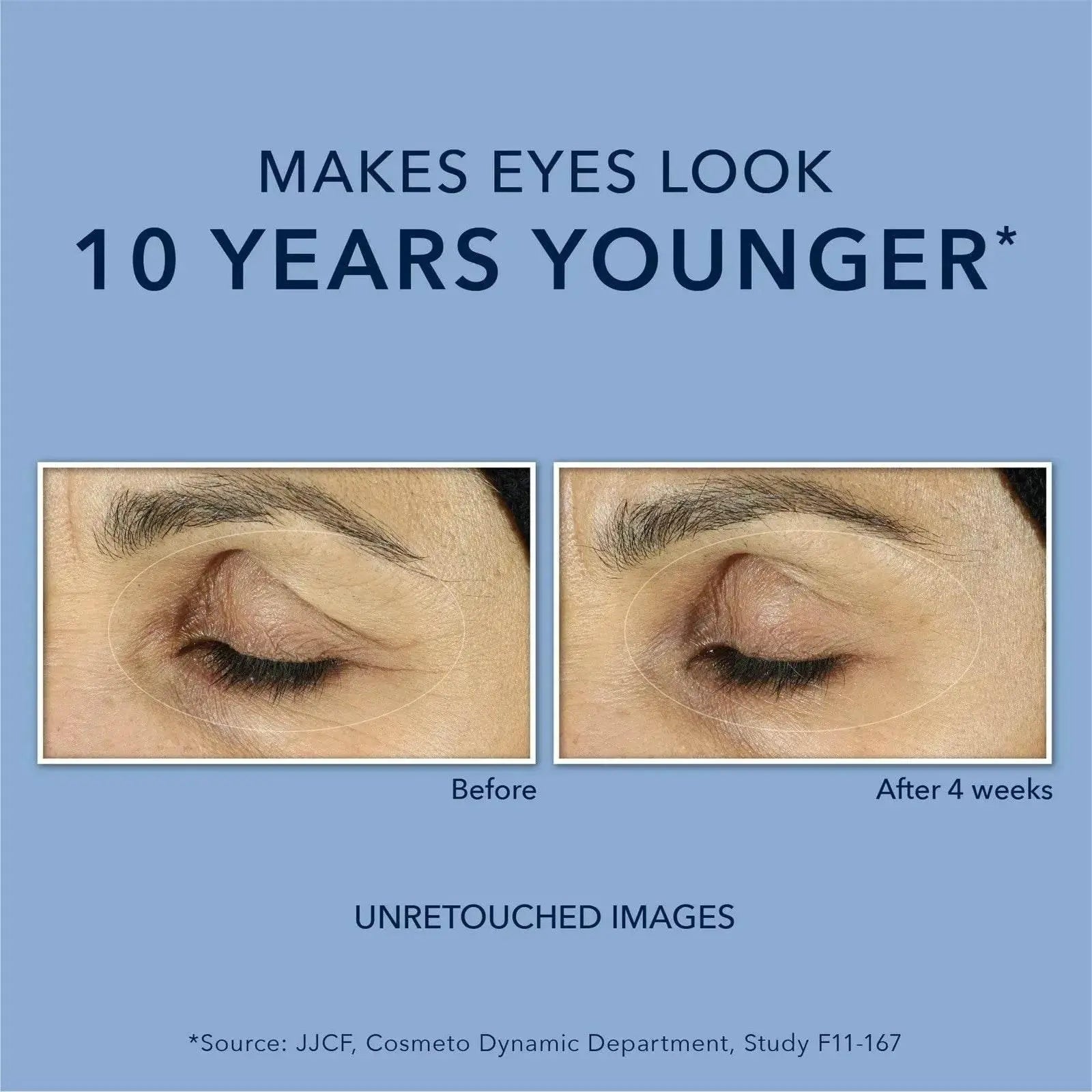 Roc Retinol Anti-Wrinkle + Firming Eye Paste For Dark Circles & Puffy Eyes Retinol Anti-Wrinkle Firming Eye Cream - ACHETE LTD