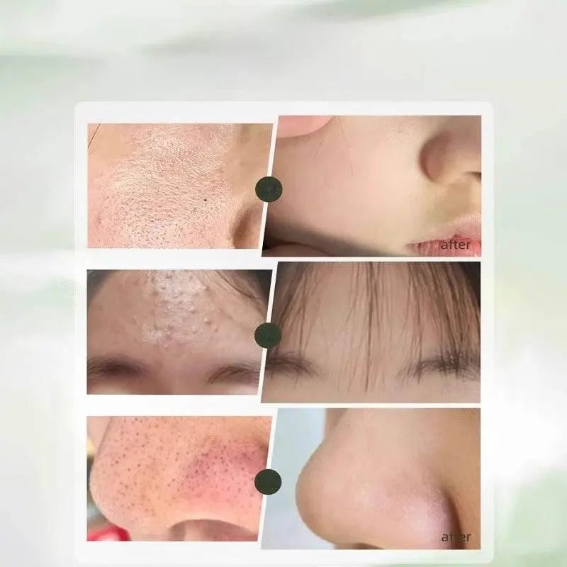 Youth Facial Cleanser Oil Control Acne Marks Blackhead Skin Care Male Adolescence Student Only Amino Acid Cleansing Cleansing - ACHETE LTD