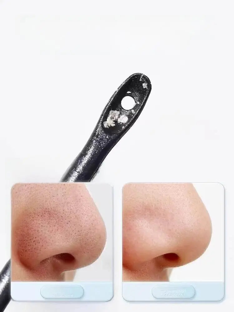 Disposable Blackhead Removal Cotton Swab Stick Pop Pimples Acne Scraper Cleaning Cotton Swab Makeup Dedicated Cotton Swabs Facial Eye - ACHETE LTD