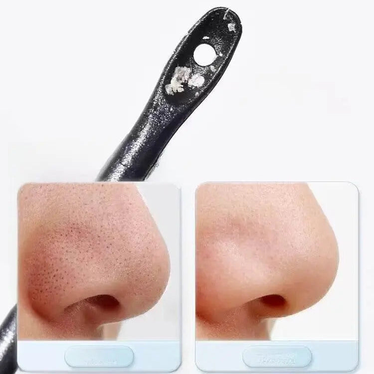 Disposable Blackhead Removal Cotton Swab Stick Pop Pimples Acne Scraper Cleaning Cotton Swab Makeup Dedicated Cotton Swabs Facial Eye - ACHETE LTD