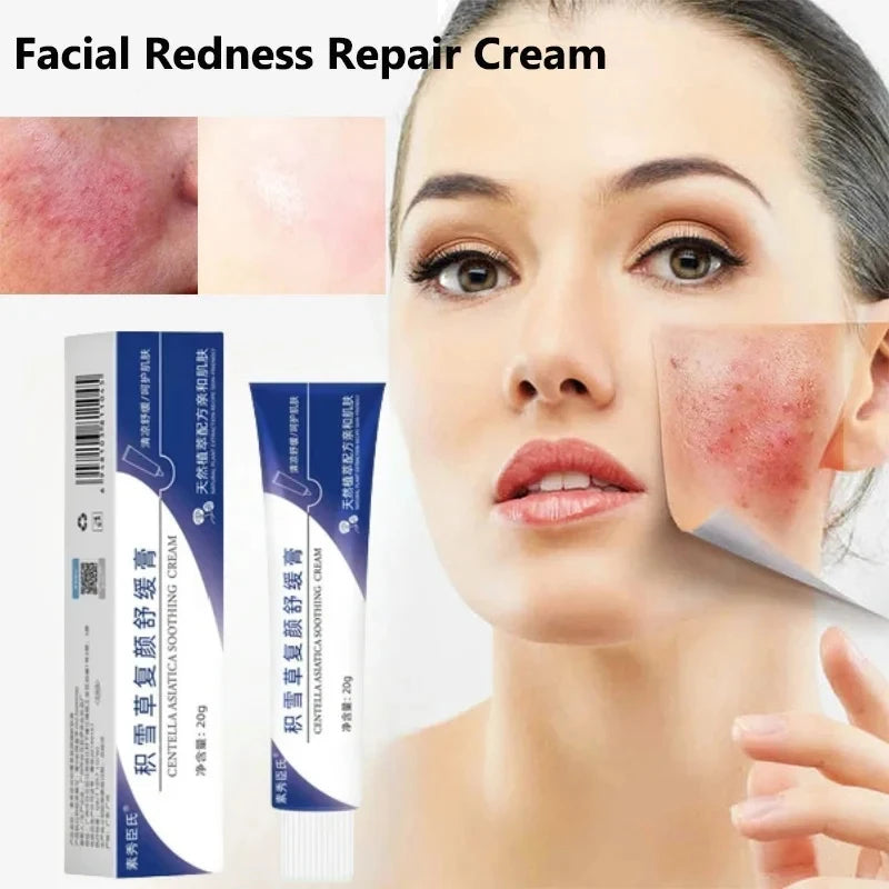 Instant Repair Facial Redness Cream Soothing Red Blood Rosacea Treatment Improve Sensitive Skin Moisturizer Skin Care Cosmetics