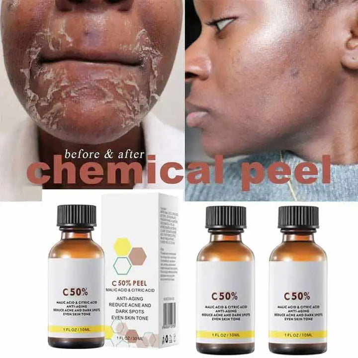 Yellow Peeling Oil Bleaching Dark Skin Spots Remove Dead Skin Lighten Melanin Scrub Exfoliating Whiten Moisturize Body Skin Care