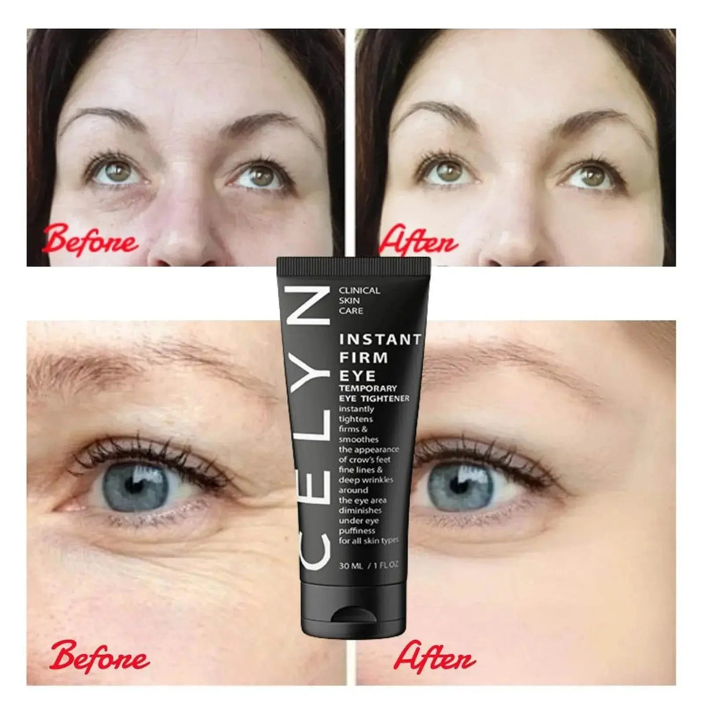 Instant Firm Eye Tightener, Eye cream, eye firming agent, eye lifting, firming, removing eye bags, wrinkle removal, and eye care - ACHETE LTD