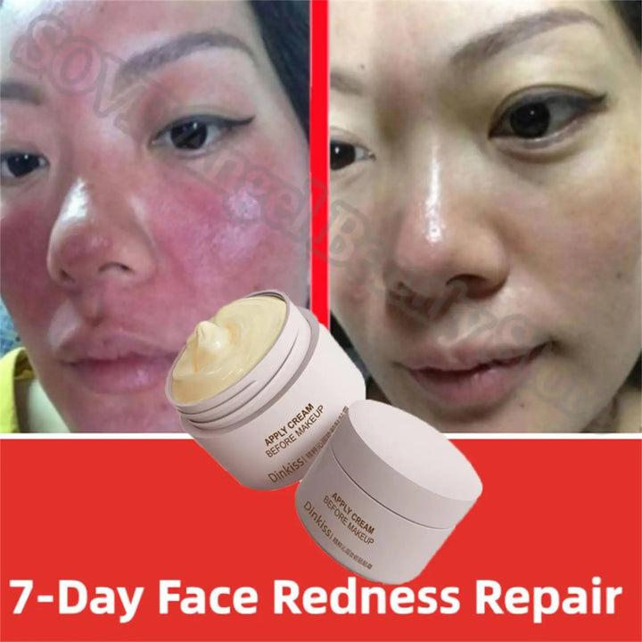 Korean Redness Repair Cream: Soothes & Moisturizes Sensitive Skin