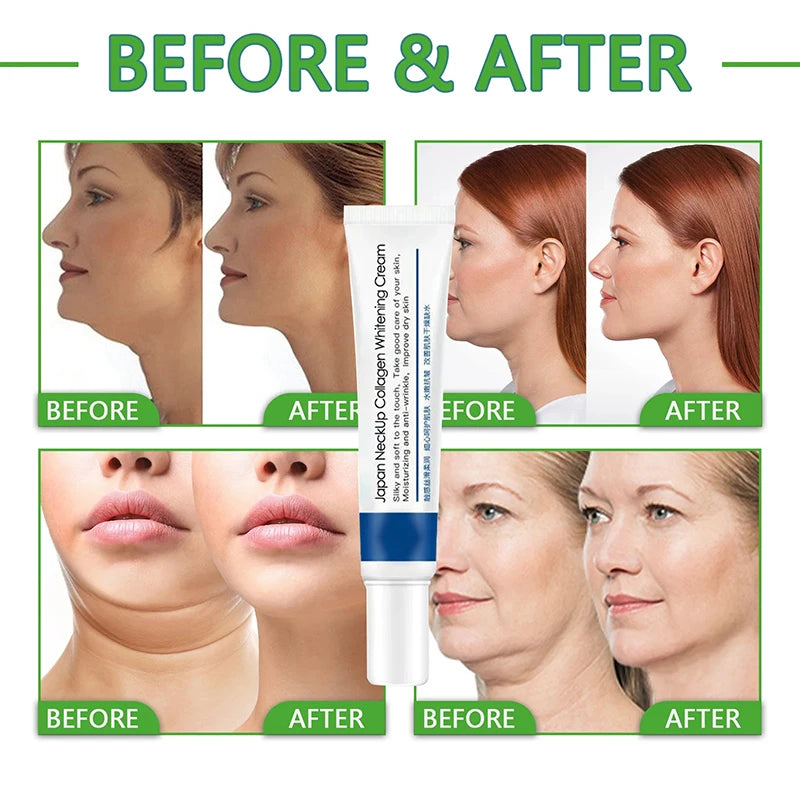 Anti-Aging Collagen Neck Cream | Tightens & Lifts | Reduce Fine Lines | Moisturizing Skincare