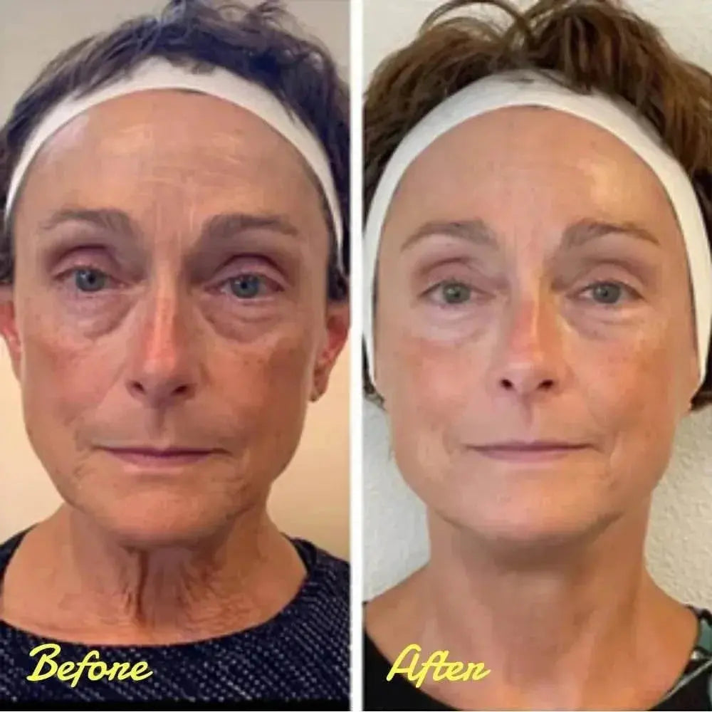 Instant Firm Eye Tightener, Eye cream, eye firming agent, eye lifting, firming, removing eye bags, wrinkle removal, and eye care - ACHETE LTD