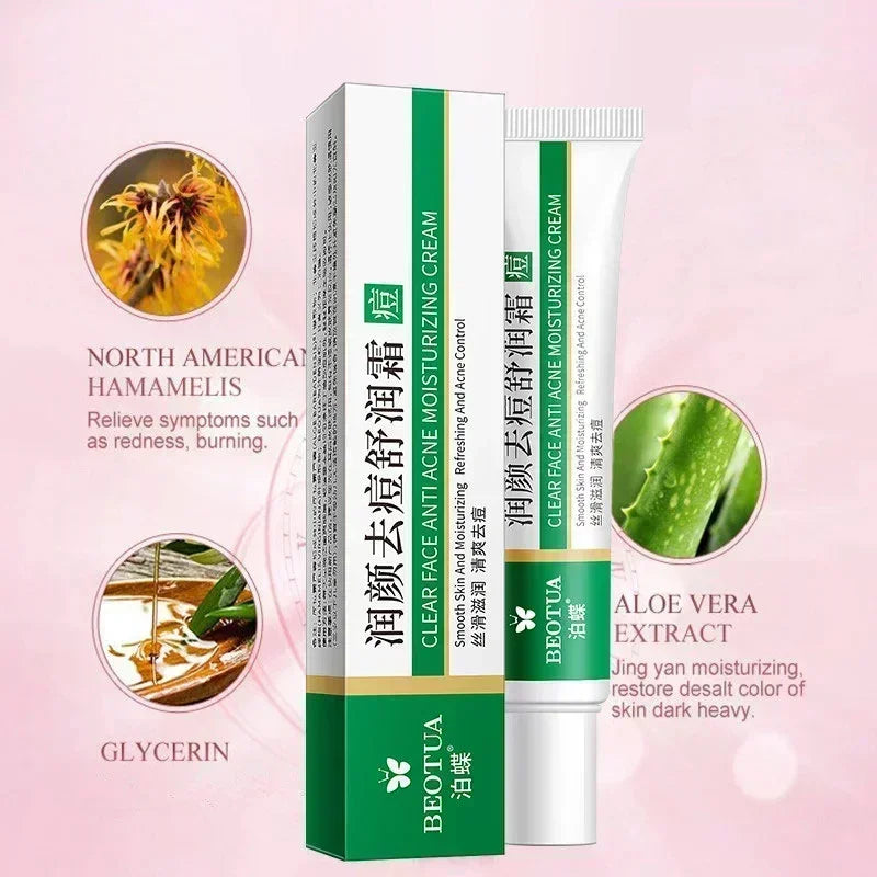 Korean Acne Treatment Cream - Repair, Control, and Whiten Skin | 20g | Gentle Care