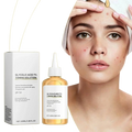 Glycolic 7% Toner Ordinary Glycolic Toner Remove Acne Lightening Acne Marks Removing Acne Repairing And Rejuvenating Skin 100ml - ACHETE LTD